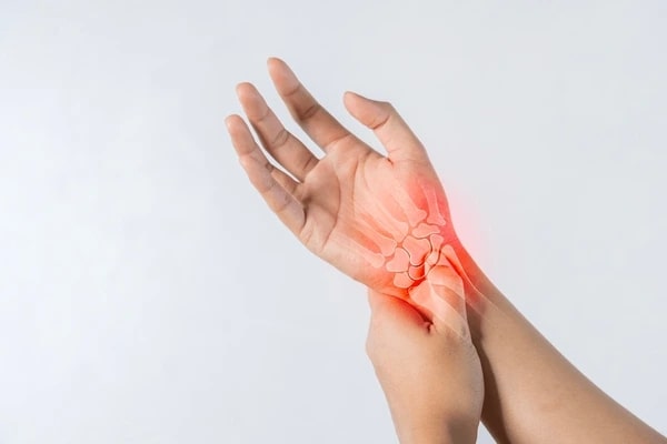 Arthritis
