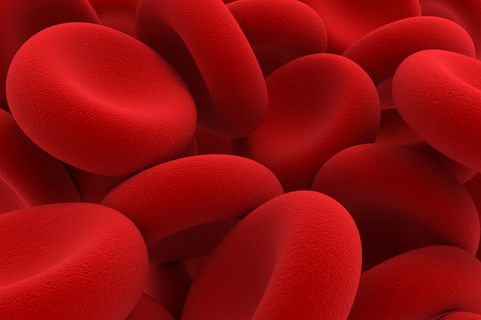 Anemia